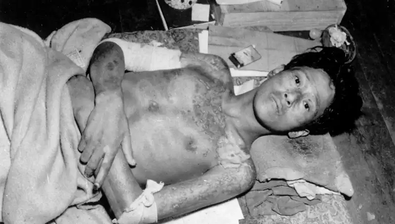 80 Yıl Sonra Nagasaki’den Çarpıcı Uyarı: Nükleer Felaket Tehdidi!