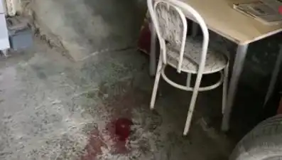 Sandalyeden Düşen Adamın Hayatı Değişti: Ağır Yaralanma Sonrası Gelişmeler