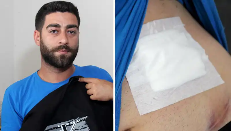 Karnındaki Ağrı, Röntgendeki Korkunç Gerçeği Ortaya Çıkardı