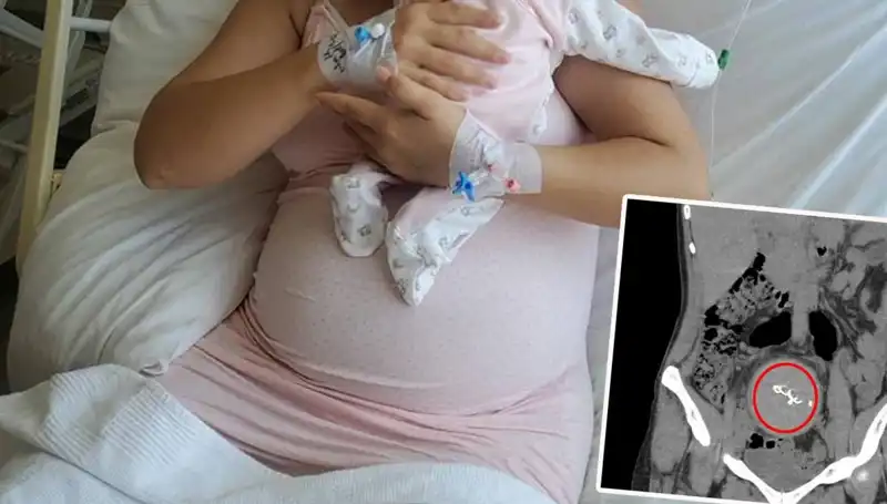 İhmalin İç Yüzü: Doğumda Unutulan Bebek ve Gazlı Bez Skandalı