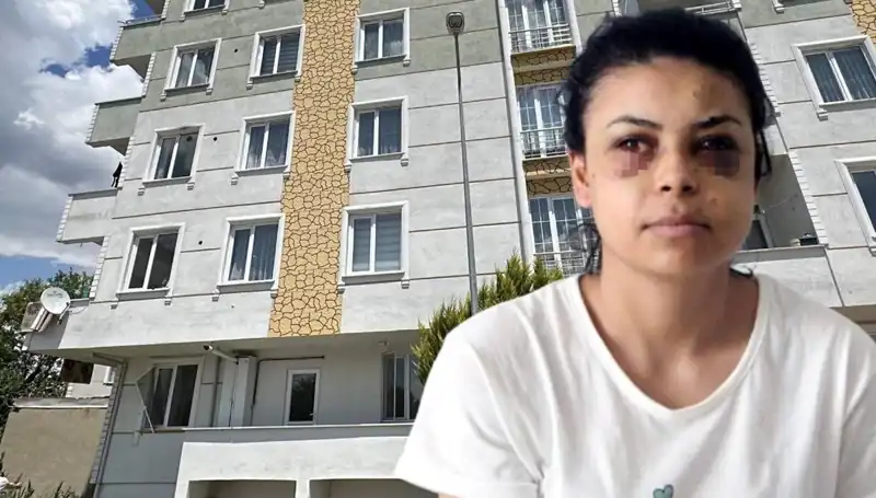 Düğün Eğlencesinde Maganda Faciası: Genç Kızın Gözünden Vurdu