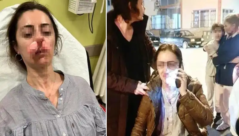 Otomobil Kapısı Artık Silah Sayıldı: Eşinin Sevgilisiyle Hesaplaşma!